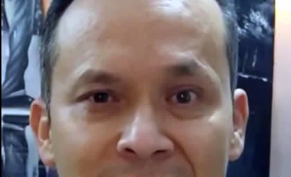 paciente con blefarospasmo derecho